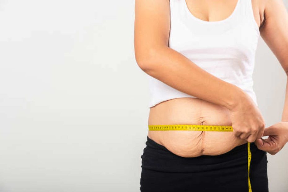 Get to know Bariatric Surgery