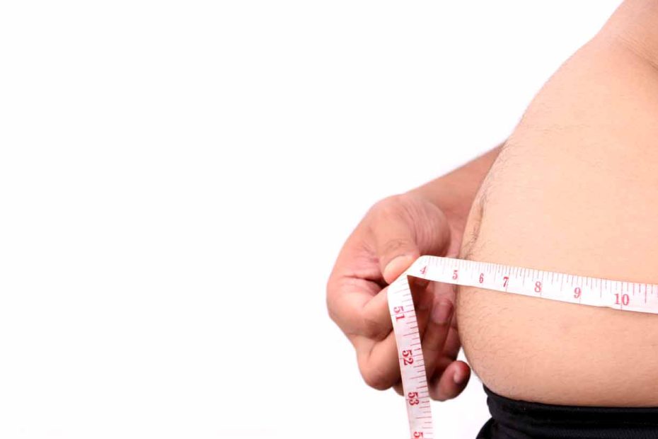 Bariatric surgery