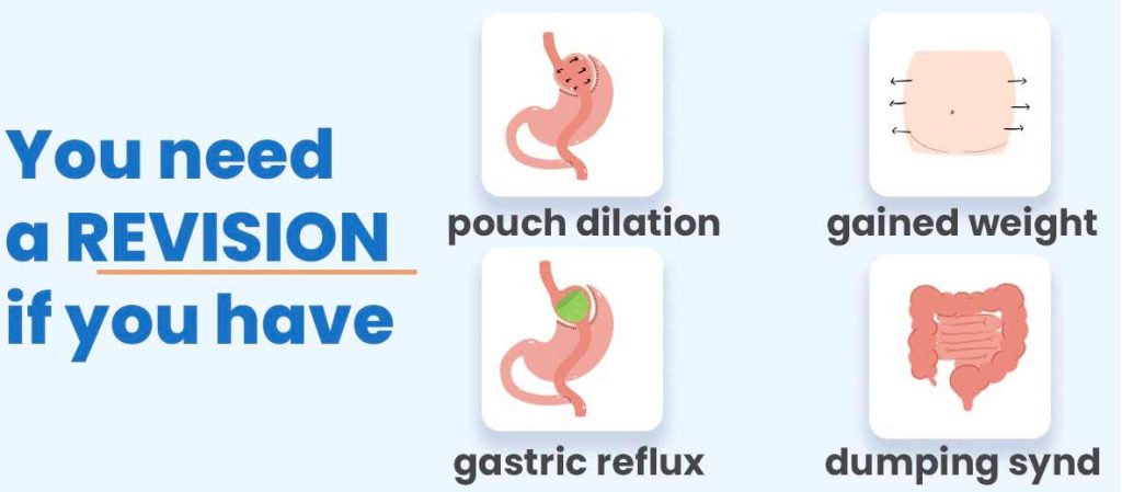 gastric bypass revision
