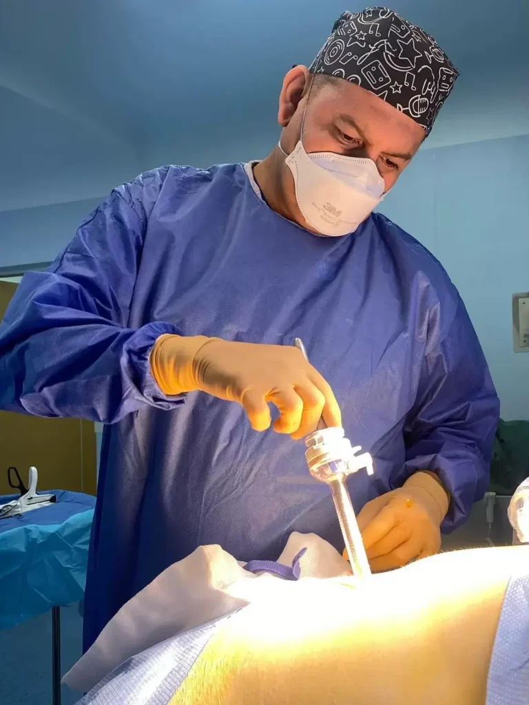 Bariatric Surgery in Mexico